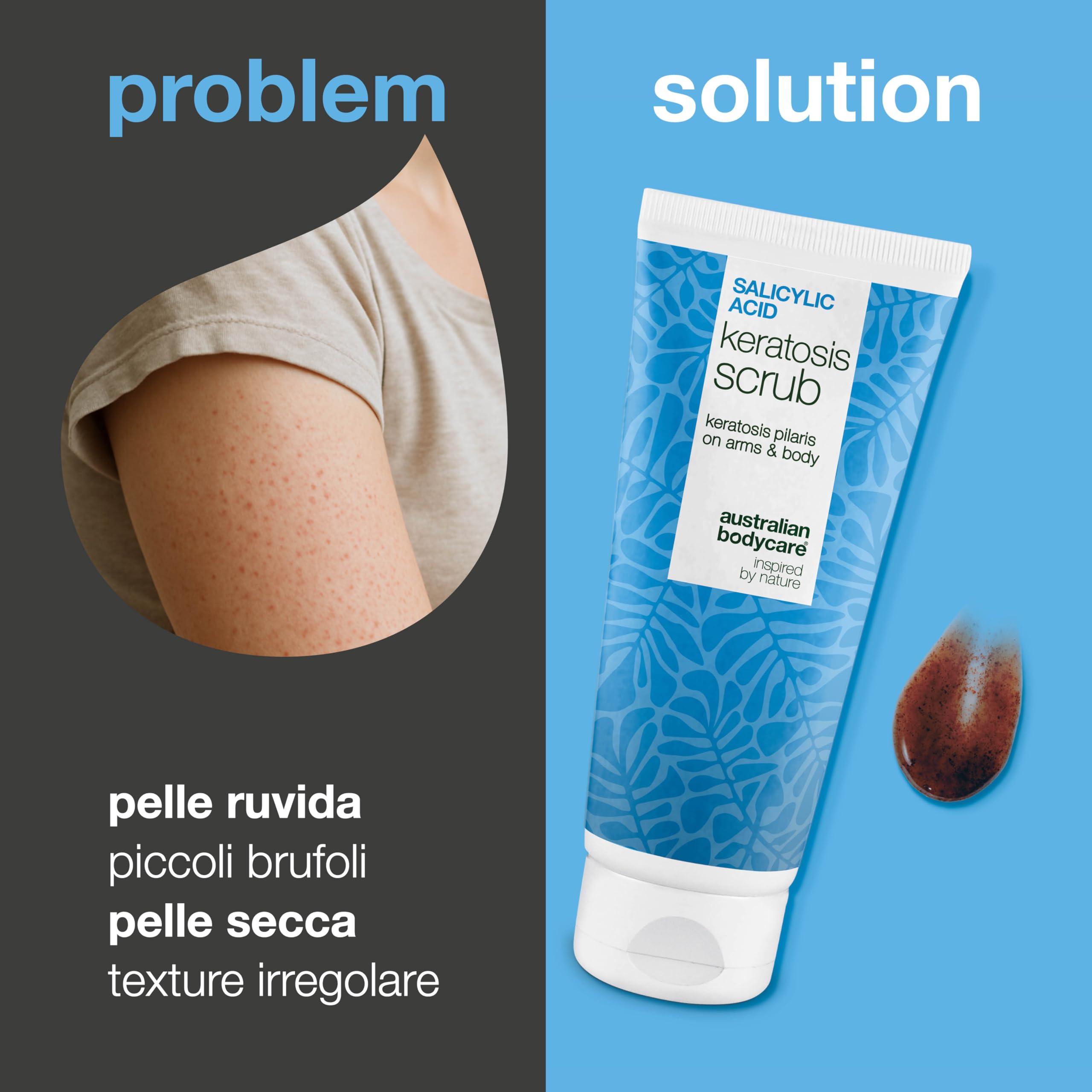 Cheratosi pilare peeling chimico (AHA/BHA) e fisico – esfoliante scrub corpo contro cheratosi pilare, pelle a fragola e peli incarniti con acido salicilico, acido glicolico, allantoina e glicerina