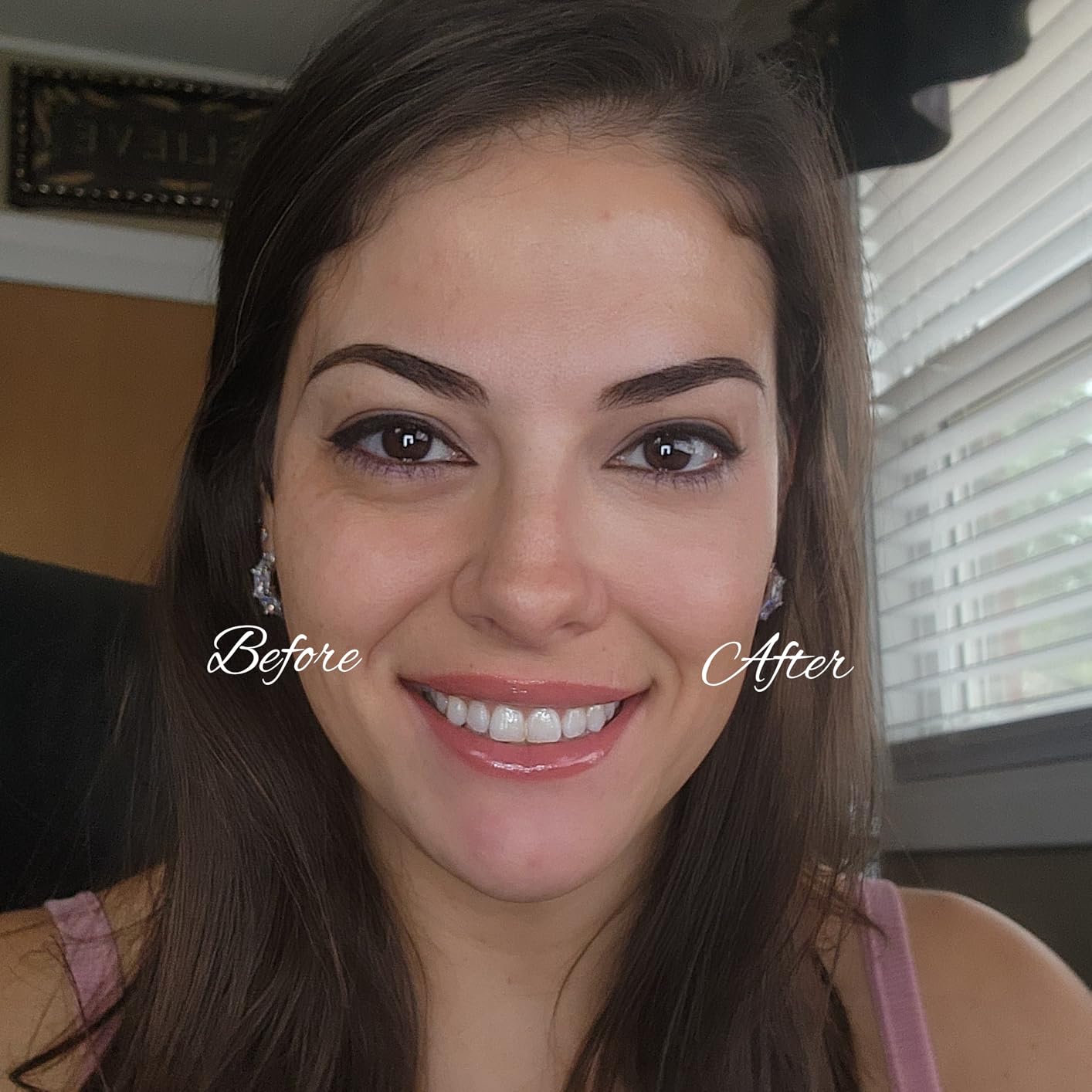 Works great for dark circles!