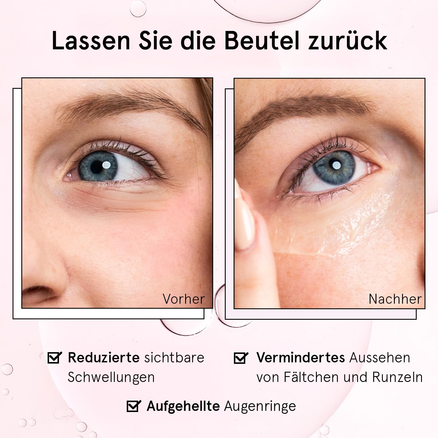 grace & stella, Augenroller mit Augencreme genen Falten und Augenringe mit Retinol & Koffein Augen-Roll-On mit Augencreme gegen Tränensäcke (15ml)