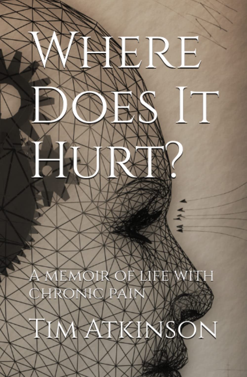 Where Does It Hurt?: A memoir of life with chronic pain