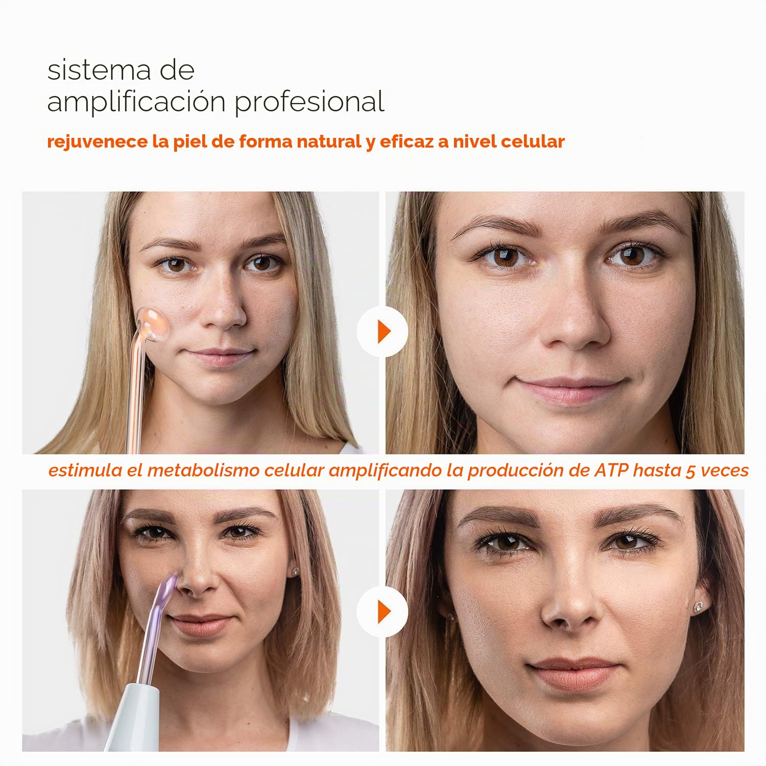 NuDerma - Varita de Terapia Profesional Para la Piel, Portátil, de Alta Frecuencia, Con 6 Varitas de Neón y Argón, Tratamiento Para Acné, Tensor, Reducción de Arrugas y Levantador