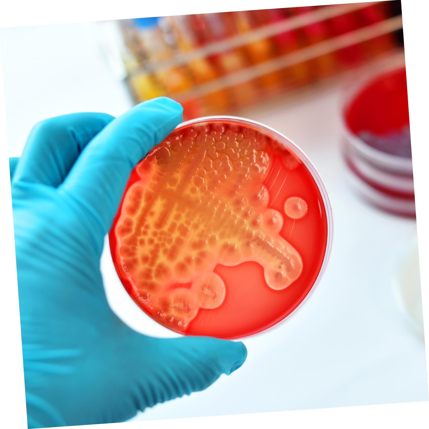 Anneome 20 Placas de Agar Prevertidas de 7cm para Cultivo y Experimentos Científicos, Listas para Usar, Fáciles de Transportar