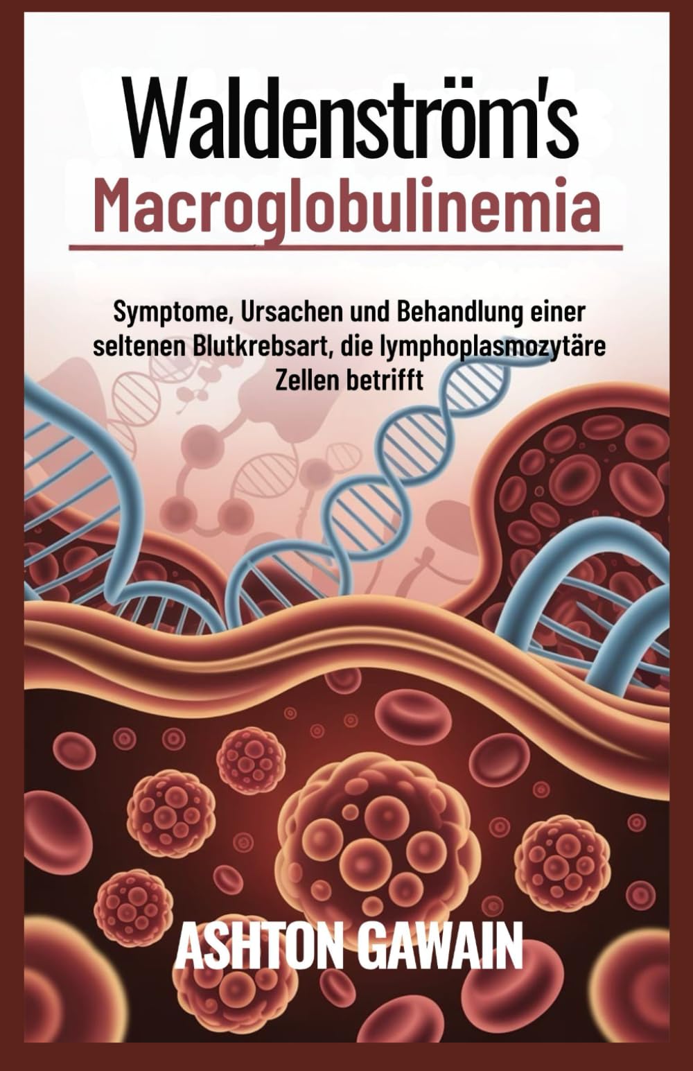 Waldenström’s Macroglobulinemia: Symptome, Ursachen und Behandlung einer seltenen Blutkrebsart, die lymphoplasmozytäre Zellen betrifft