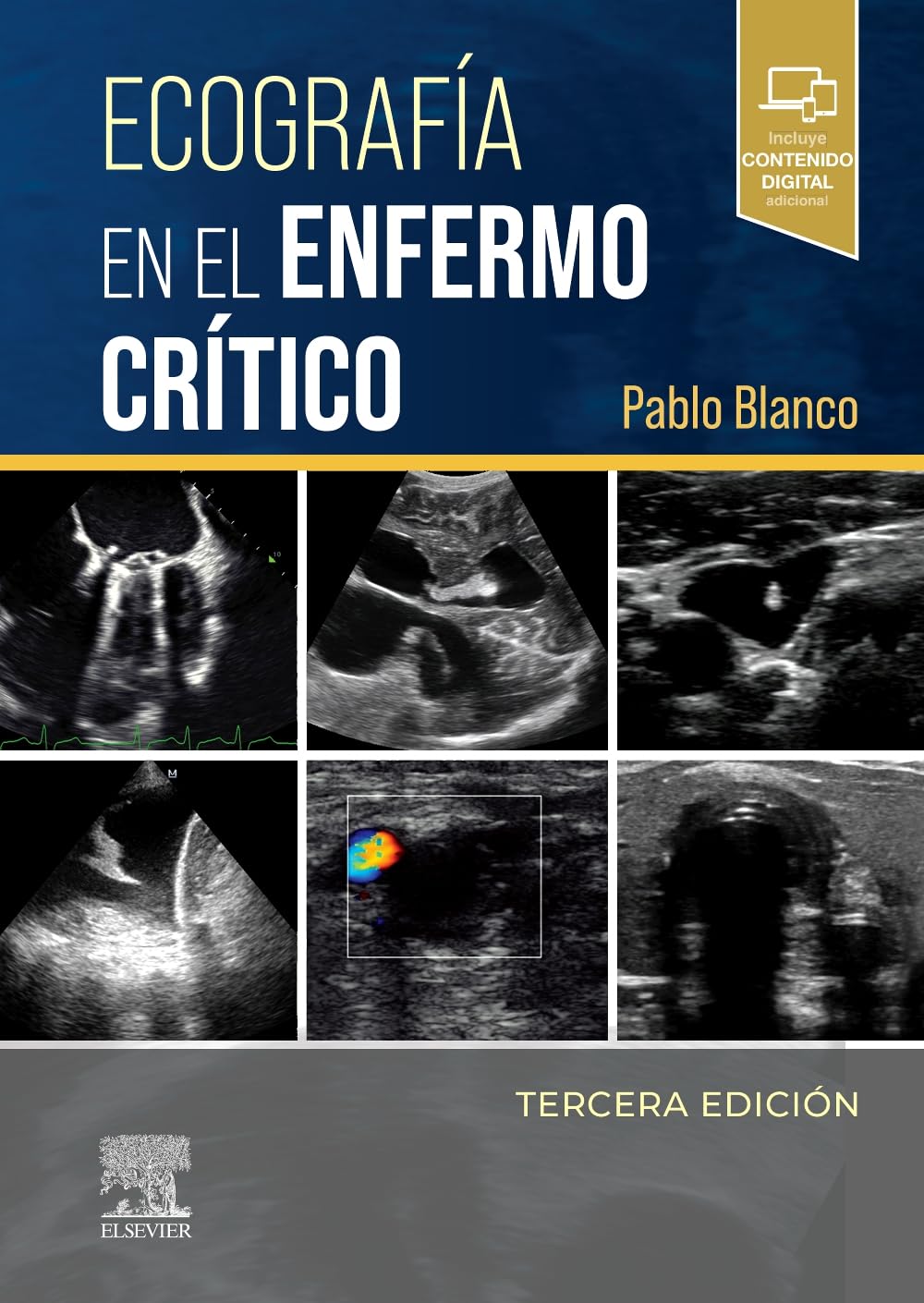 Ecografía en el enfermo crítico