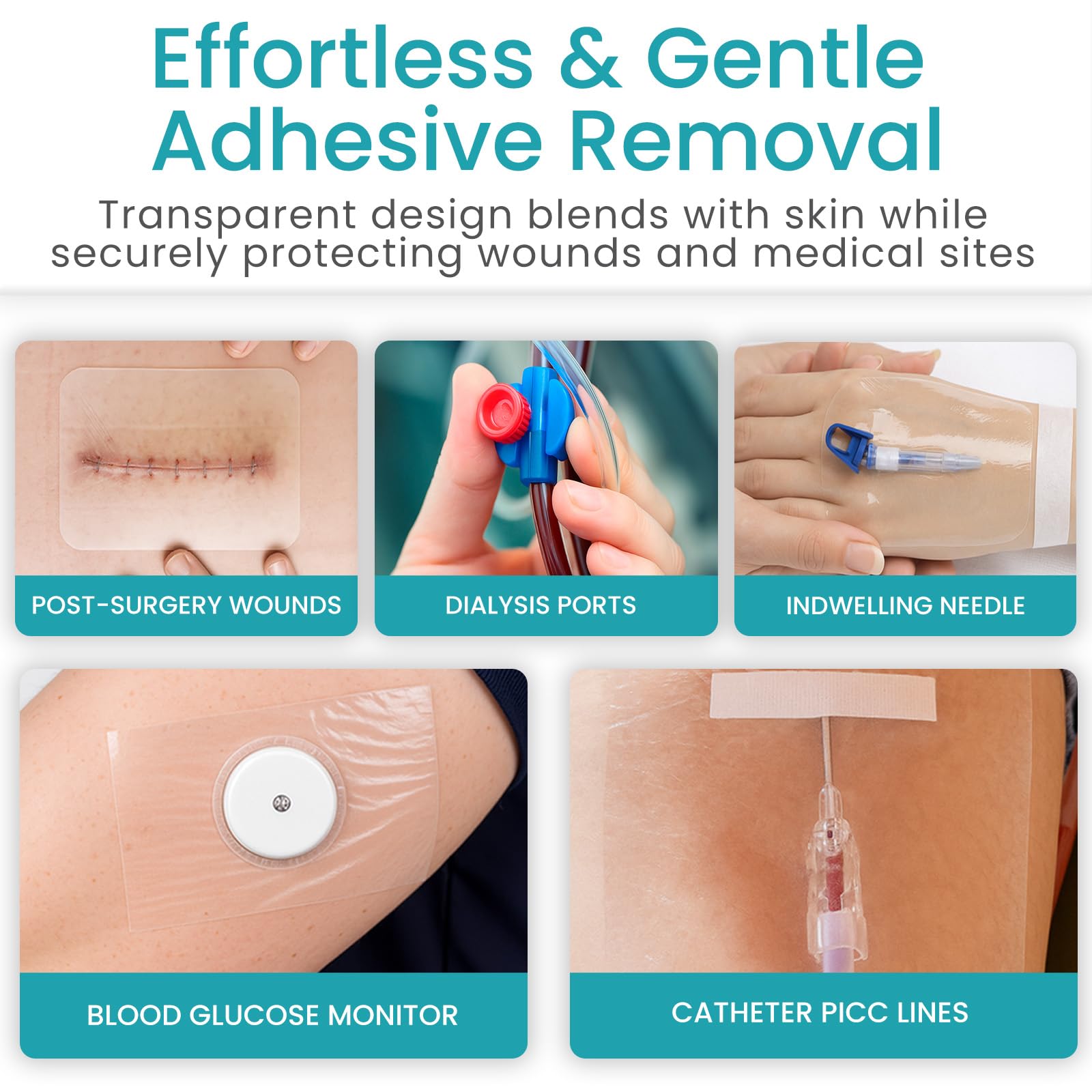 ViveCare Großer transparenter Folienverband, wasserdichte Bandagen, transparente Wundabdeckung zum Duschen, Tattoos, Duschschutz für nach Operationen, postoperative Pflaster für die Haut (17,8 x 17,8