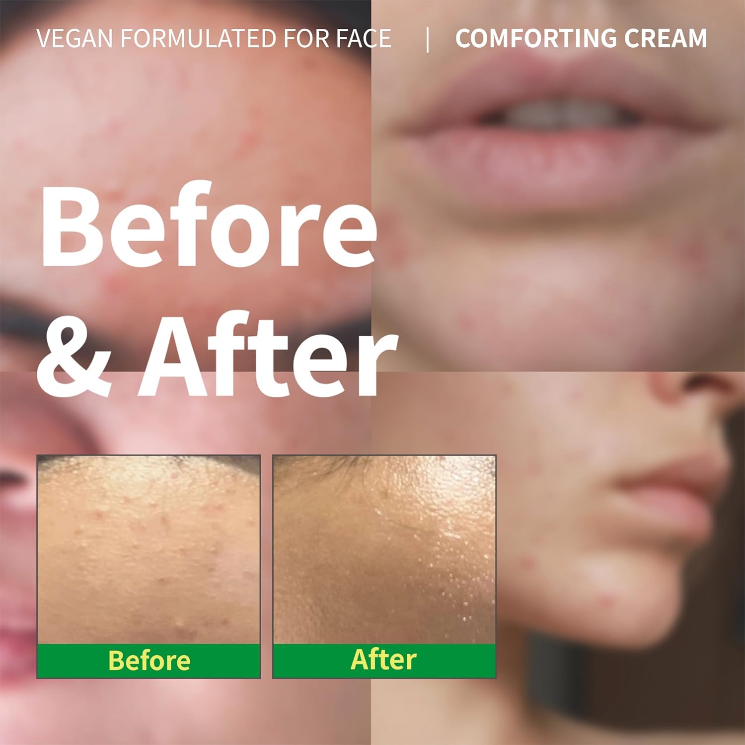 Panthenol Cream – Korean Skincare for Glass Skin with Airless Pump, 1.69oz | Hydrating Face Moisturizer with Centella Asiatica and Hyaluronic Acid | Soothing Barrier Repair Cream - Image 2