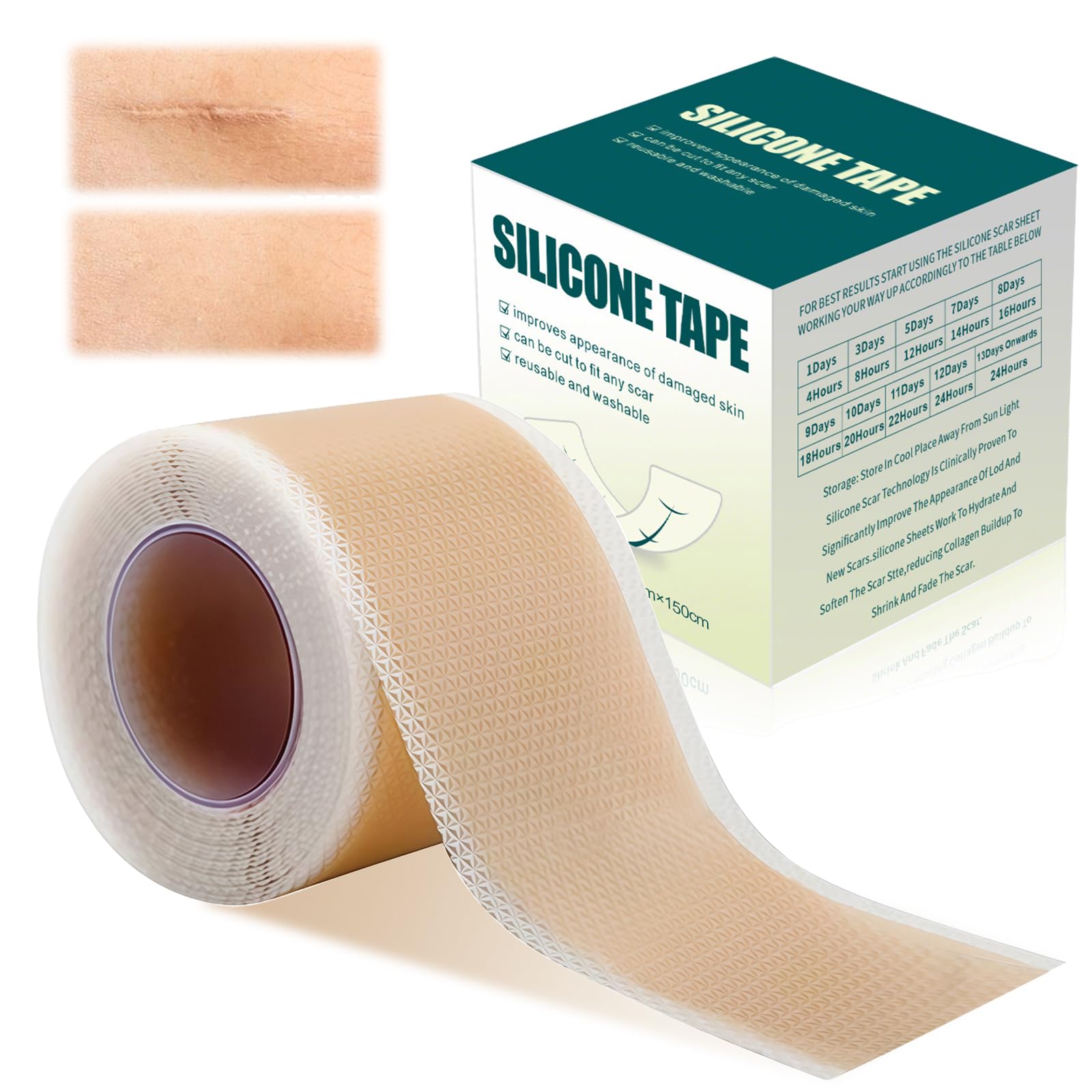 Cerotti In Silicone Per Cicatrici – Rotolo 4 X 300 Cm, Ritagliabile, Riutilizzabile, Per Taglio Cesareo, Cheloidi, Ustioni, Acne