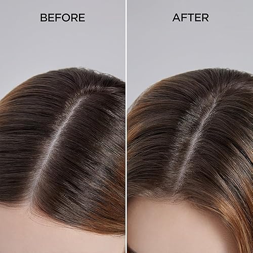 Miniatura 5 de AYUNCHE Derma - Suero calmante para el cabello, 2.7 fl oz (2.7 fl oz) [para cuero cabelludo seco y debilitado] | Hidratante y calmante | Cuidado del