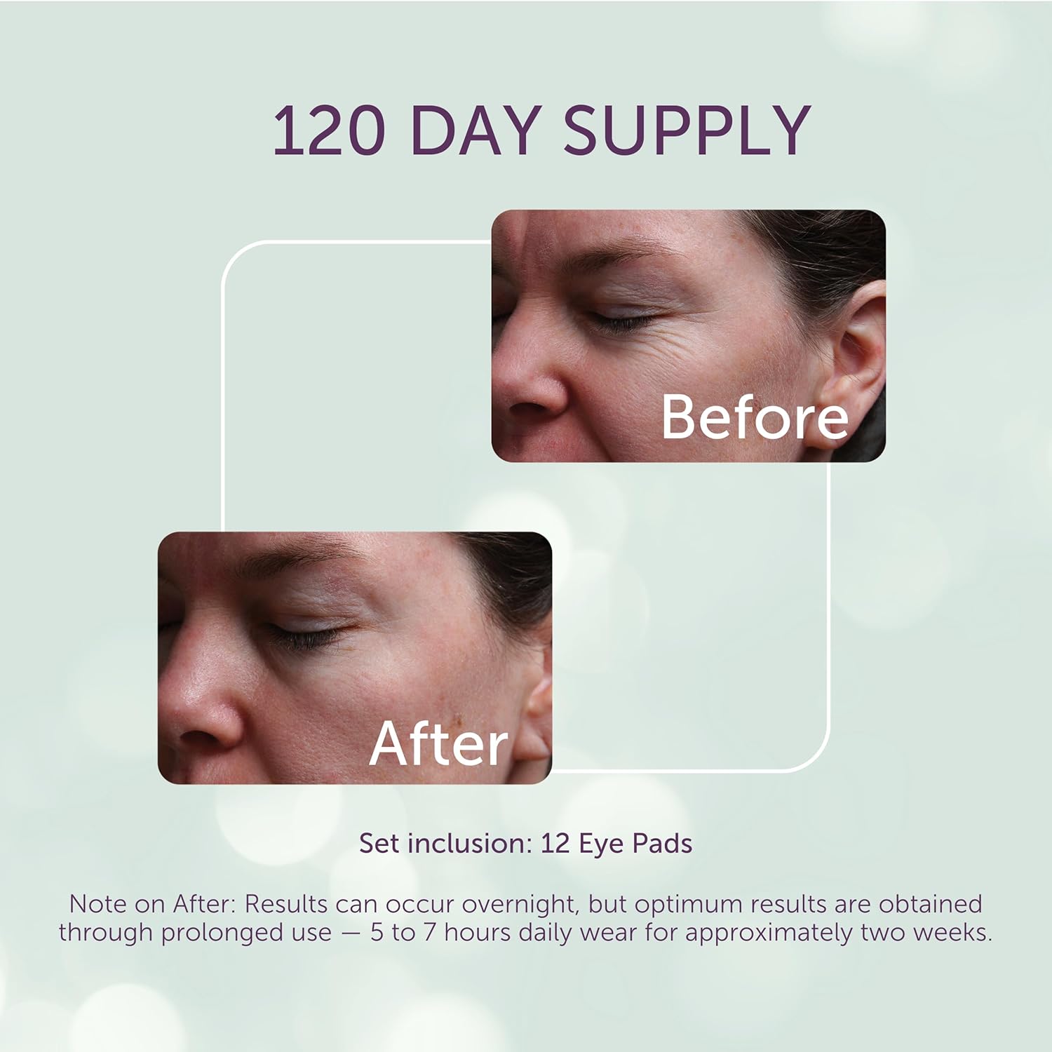 Silc Skin Silicone Eye Pads Reusable Overnight Eye Patches, Medical Grade Silicone For Fine Lines And Puffiness, 120 Day Supply