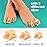 Welnove Hammertoe Corrector - 6 Pack Toe Splints - Soft Gel Toe Straighteners - Realign Bent, Curled, Crooked, Claw, Hammer Toes - Corrector for Men and Women, Large (Beige), FSA or HSA Eligible