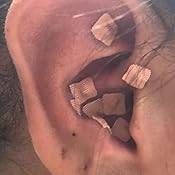 amazoncom multi condition ear seeds acupuncture kit 600 counts ebook
