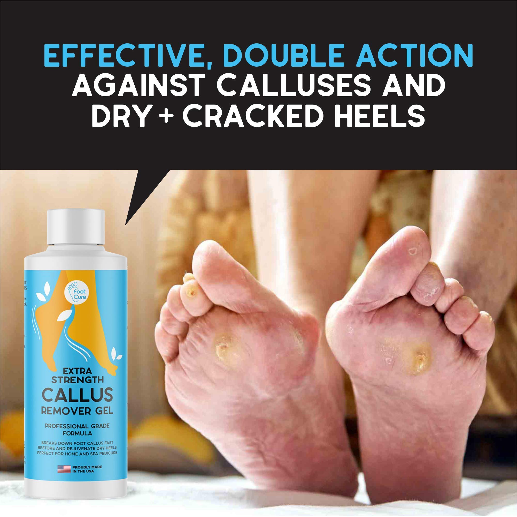 Foot Cure Callus Remover Kit for Feet Professional Extra Strength