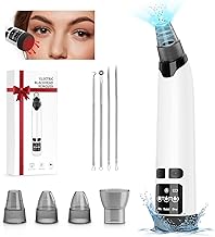 NIWOHOM Succionador de Puntos Negros con 3 Modos de Succión&4 Puntas Intercambiables&Función de Compresa Caliente para el Cuidado de la Piel Seca,Grasa,Mixta y Limpieza Profunda Quitar Puntos Negros