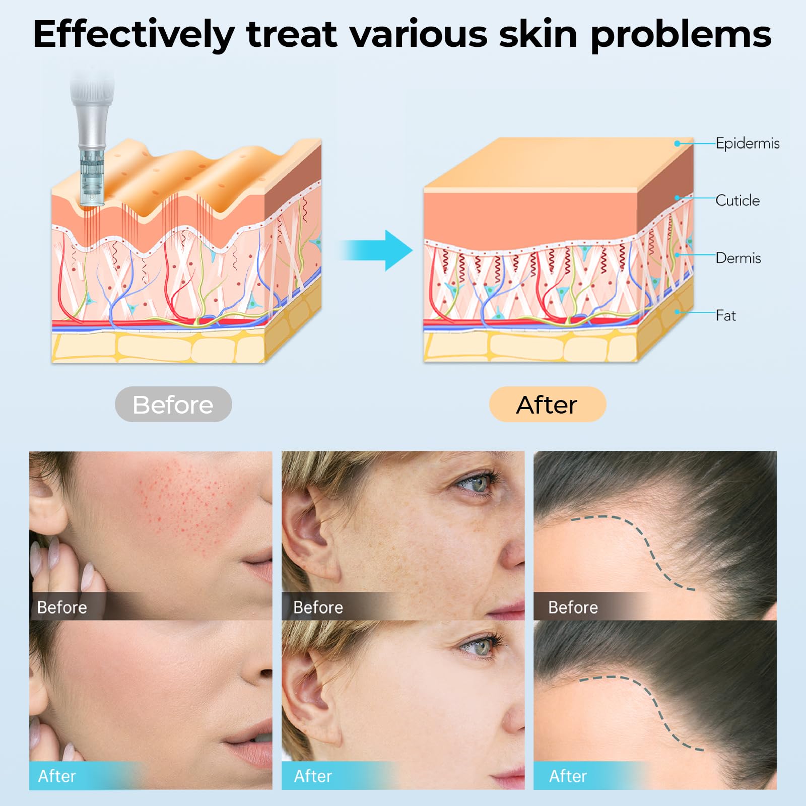 Dr.Pen M7S Microneedling Pen - Image 4