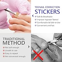 Vista 6 de Parche corrector de uñas encarnadas, 100 tiras correctoras de uñas encarnadas, parches de corrección de uñas de los pies, herramienta de tratamiento