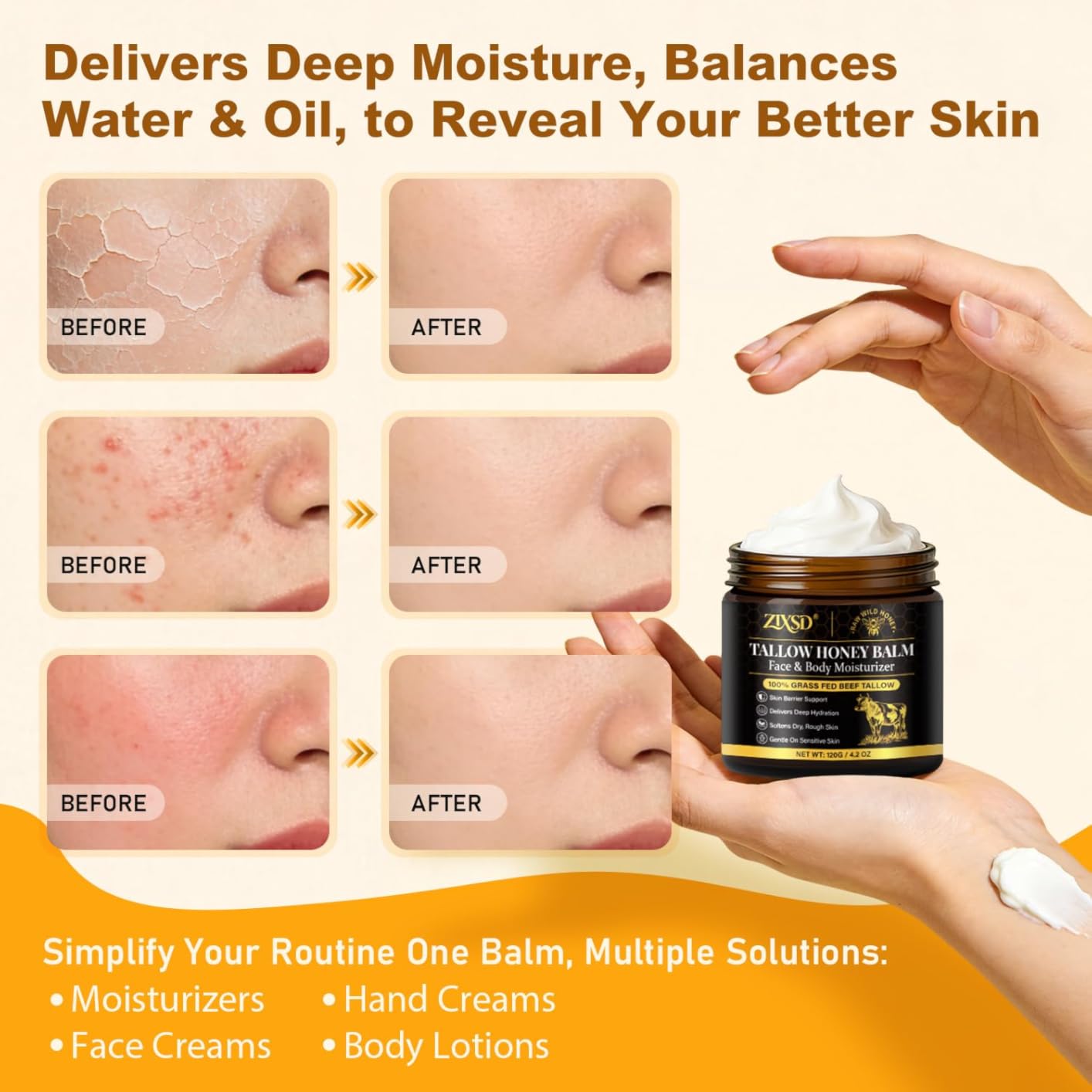 ZIXSD Beef Tallow for Skin, Beef Tallow for Face, Tallow and Honey Balm for Face, Beef Tallow & Raw Honey, Grass-Fed Whipped Tallow Cream, Face & Body Tallow Face Moisturizer Natural-4.3oz
