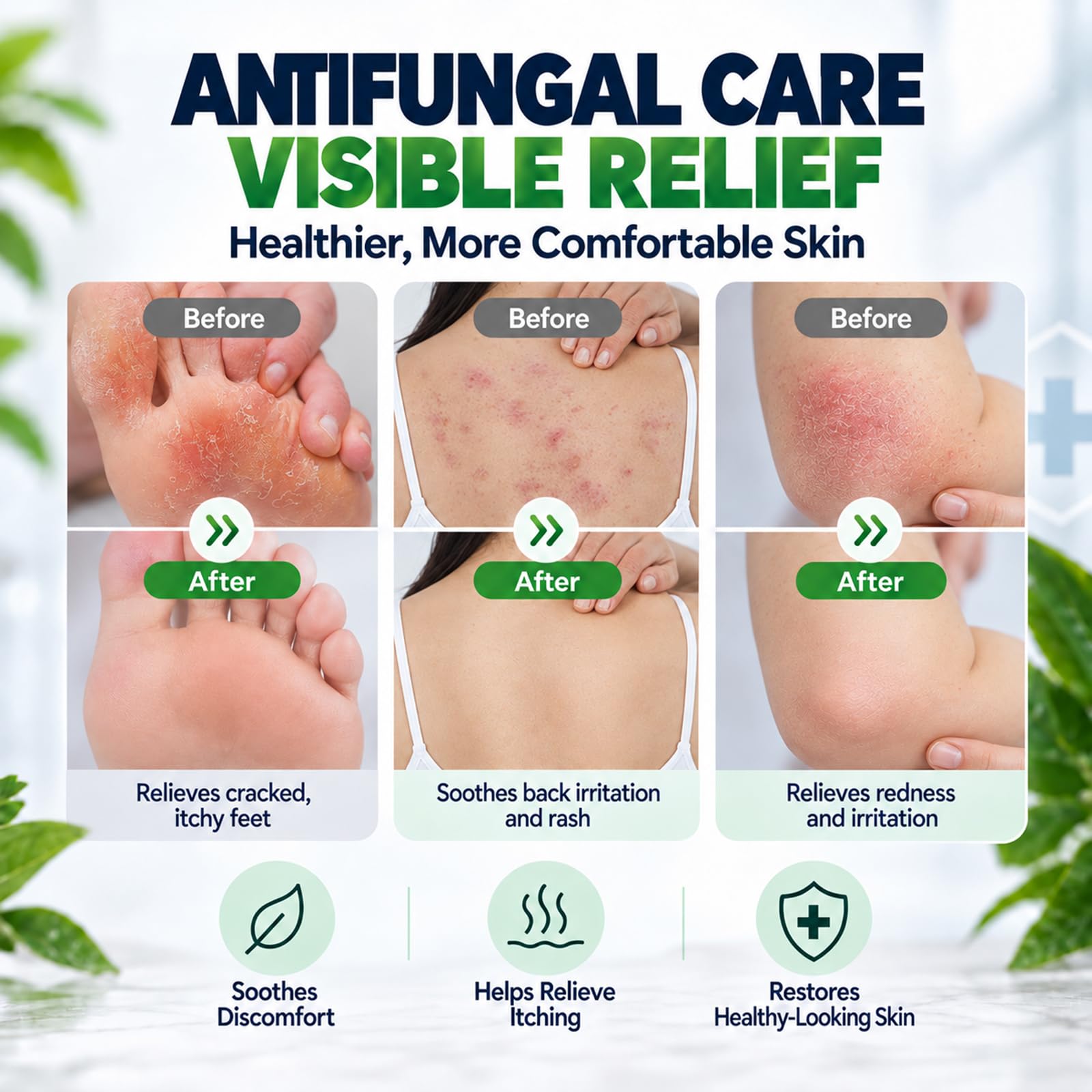 Antifungal Cream for Athlete's Foot Jock Itch Ringworm Treatment, 3 Bottles — Amazon image 4