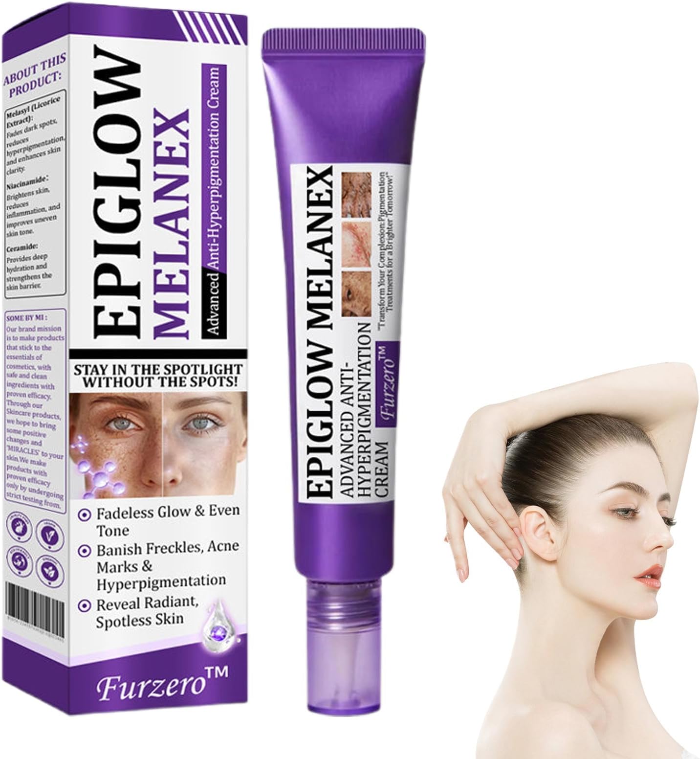 EPIGLOW MelanEX Advanced Anti-Hyperpigmentation Cream,Dark Spot Cream,EPIGLOW MelanEX cream For Hyperpigmentation Treatment,Anti Aging Face Cream,Dark Spot Remover (1)