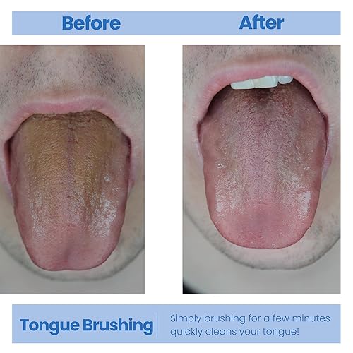 Miniatura 4 de Genco Dental Raspador de lengua para aliento fresco, raspador de lengua perfecto para adultos y niños, mejora tu higiene bucal con cepillos de