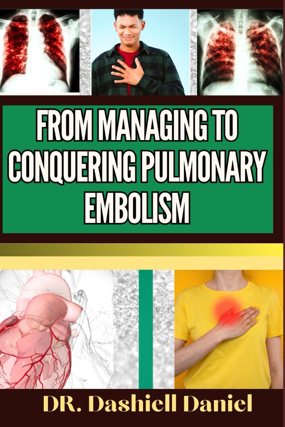 FROM MANAGING TO CONQUERING PULMONARY EMBOLISM: Expert Guide To Understanding the Causes, Recognizing Symptoms, Prevention and Embracing Effective Treatments for a Vibrant and Healthy Life