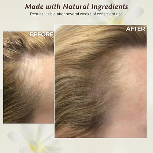 Miniatura 4 de Aceite de batana 100% natural para el crecimiento y reparación del cabello, nutre el cuero cabelludo, fortalece el cabello, reduce las puntas