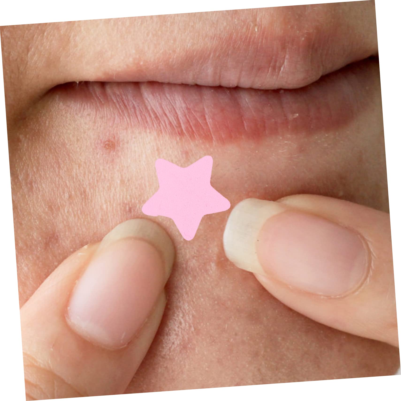 Parches Para Acné Hidrocoloides Coloridos Para Espinillas De Parches Invisibles Para Cuidado Facial Material Y Efecto Hidratante 4 Hojas X 5