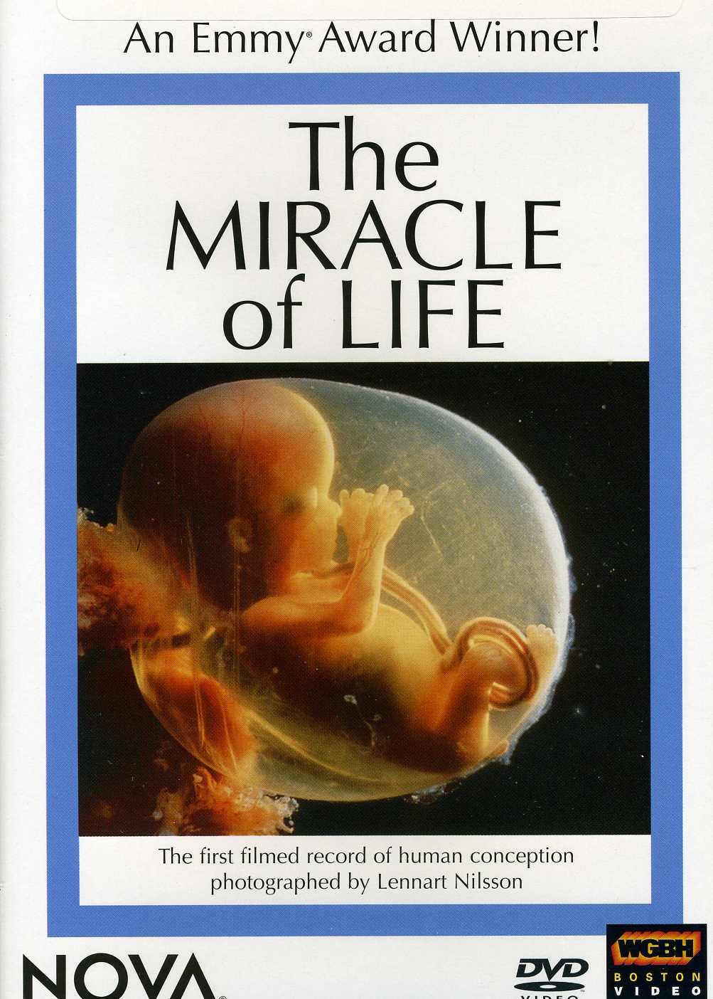 NOVA - The Miracle of Life