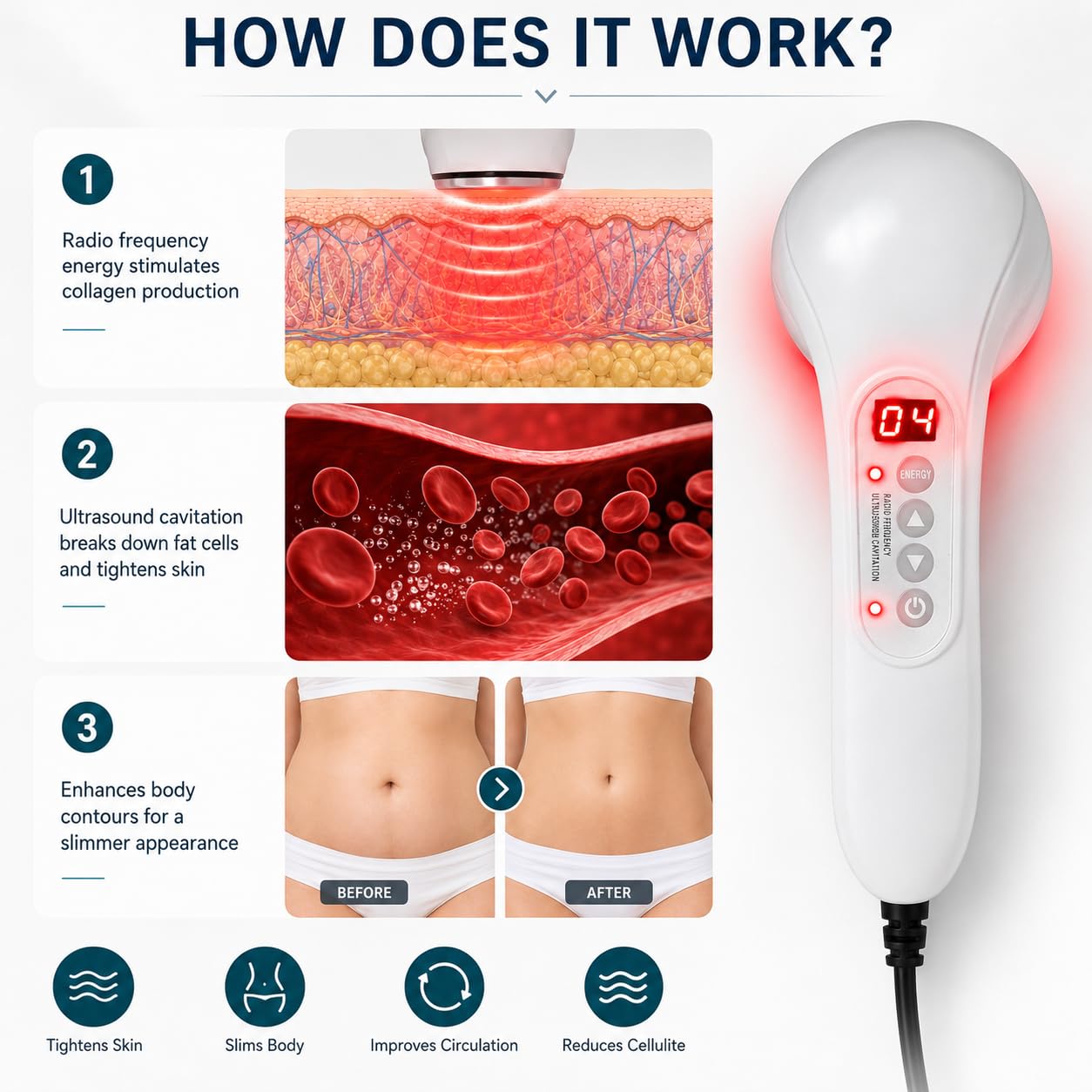 Dispositivo de radiofrecuencia para celulitis corporal, plástico blanco, incluye cable de alimentación, manual, mejora el tono