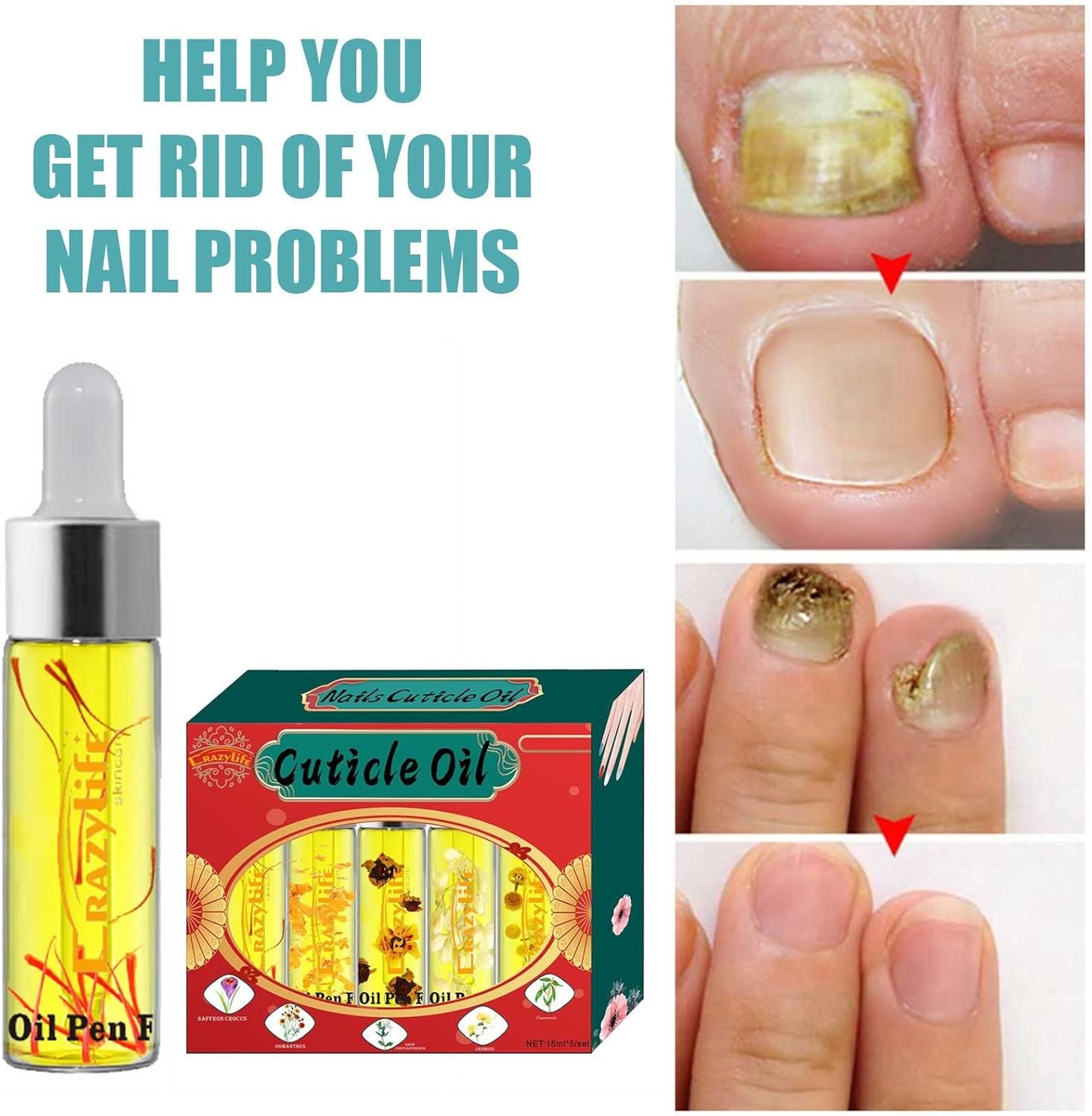 Buy MatureGirl Cutoicle Oil Nail and Toenail Treatment Pen Herbal