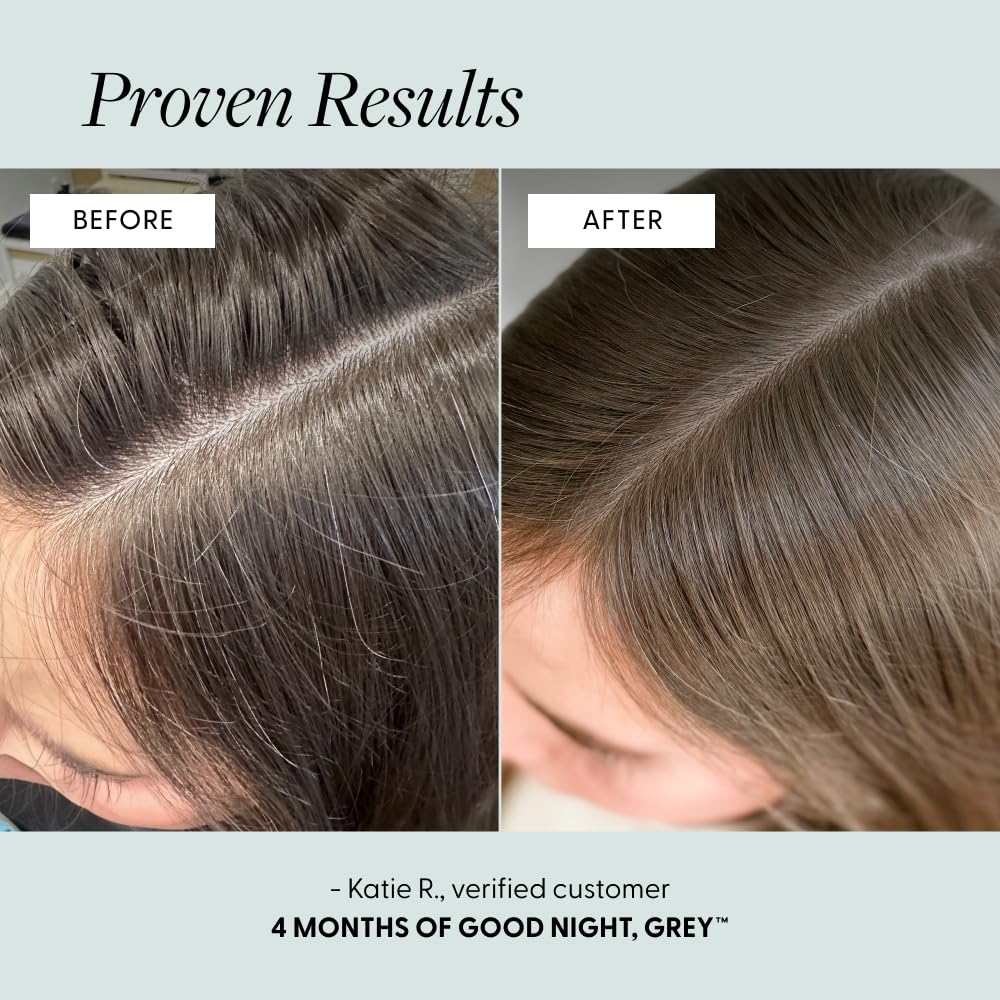 Arey Good Night, Grey Overnight Scalp Serum | Supports Color Production, Improves Hair Density & Reduces Scalp Stress | Lightweight, Oil-Free Night Treatment | 100ml