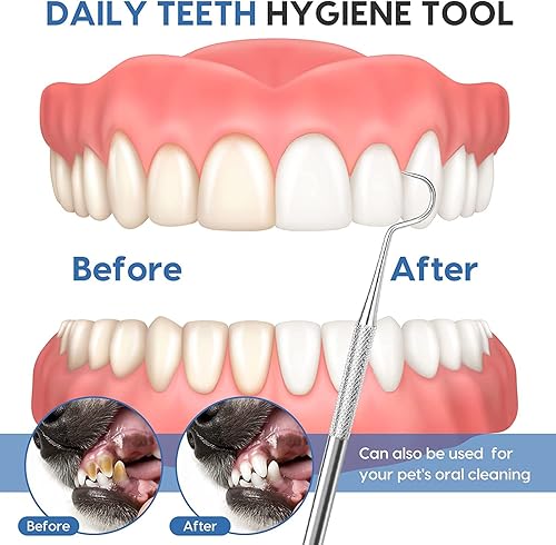 Miniatura 4 de Rascador profesional para tarter dental, 100% acero inoxidable, gancho de doble cara y púa en ángulo, herramienta de escultura de cera y arcilla, 1