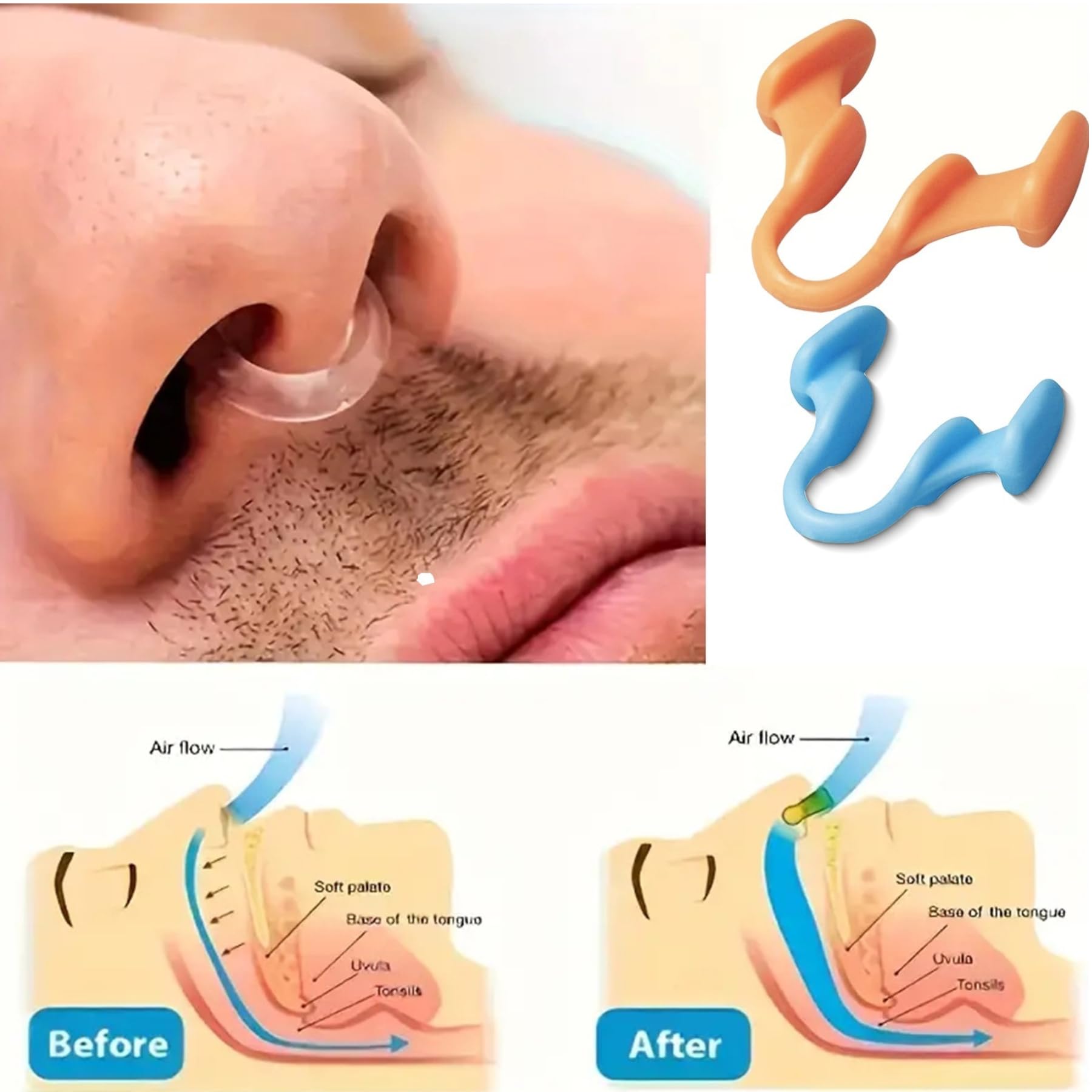 Nasal Dilator for Better Sleep Natural, Comfortable, Anti Snoring Device, Snoring Solution for Maximum Airflow and Easier Breathing 6 Pieces,Nasal dilators for Breathing — Amazon image 2