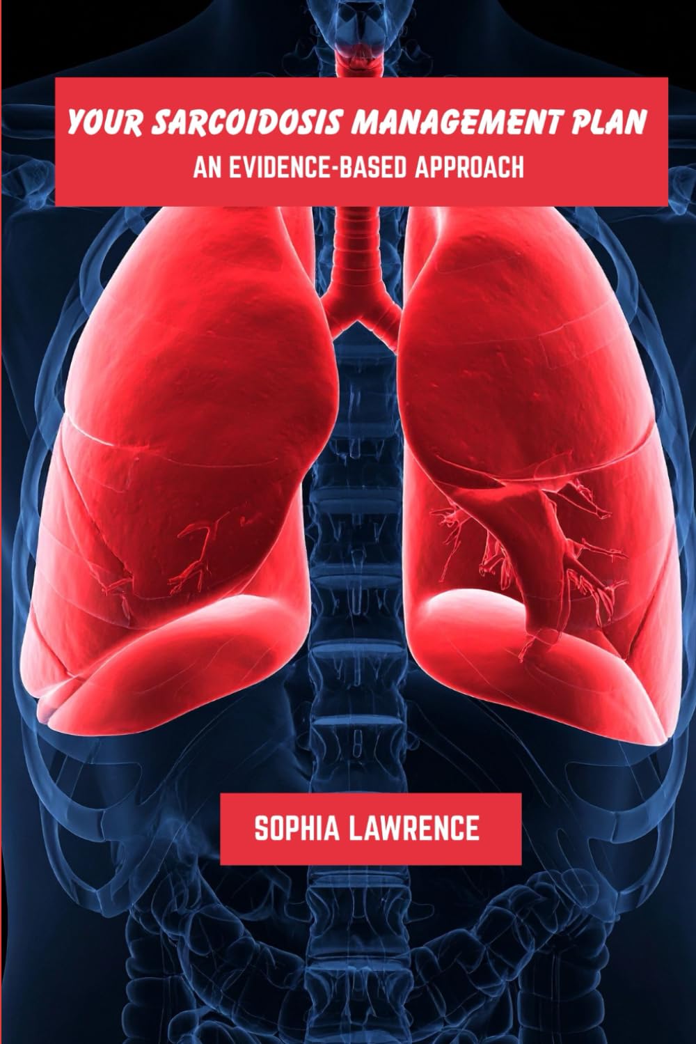 Your sarcoidosis management plan: An evidence-based approach      Paperback – December 4, 2025