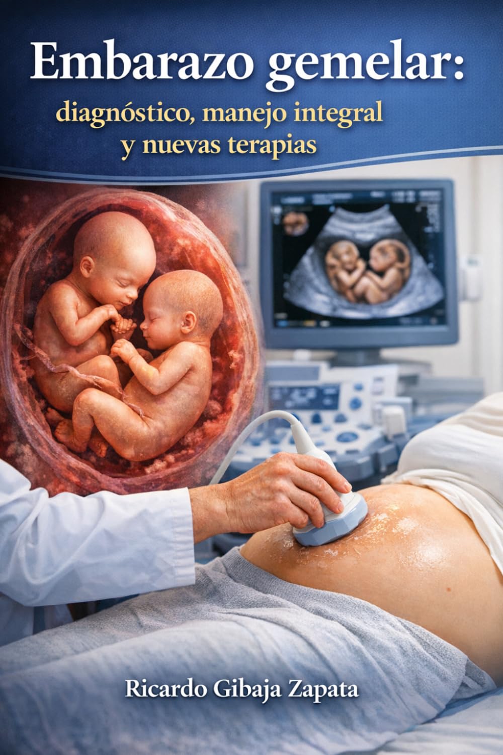 Embarazo Gemelar Diagnóstico, manejo integral y nuevas terapias