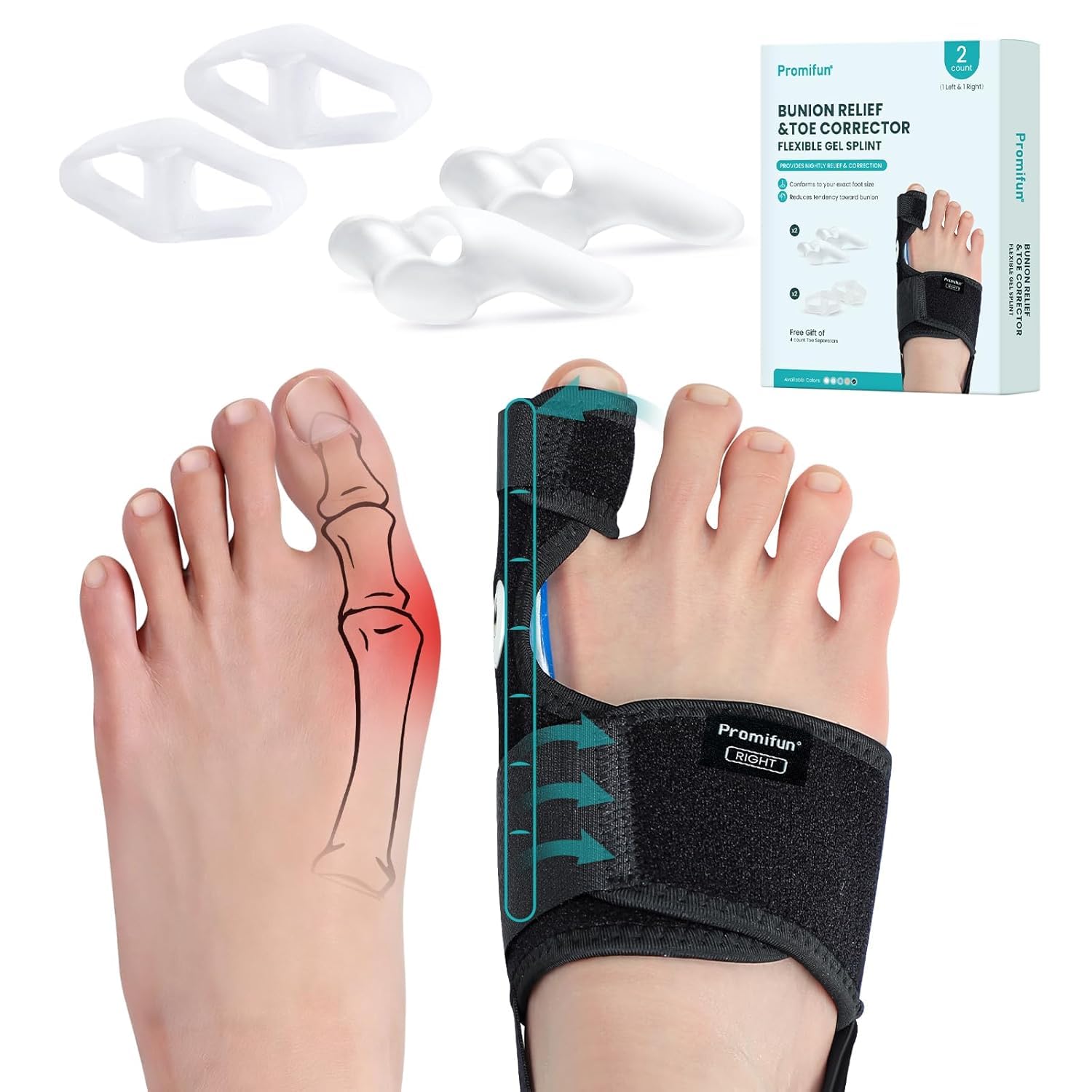 Promifun Hallux Valgus Korrektor für Frauen und Männer – 1 Paar verstellbare Hallux Valgus Schiene mit weichem Gel – Schmerzlindernde Bunion Corrector, Zehenbegradiger mit rutschfestem Riemen