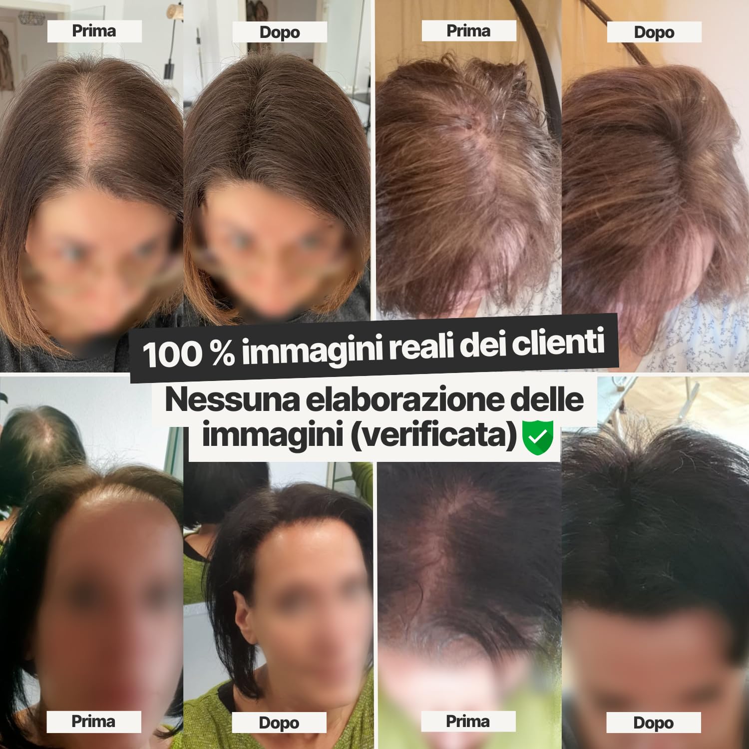 IMPERIO Fibre capelli - per l'infoltimento dei capelli per capelli più spessi e pieni in pochi secondi. Nasconde la caduta dei capelli nelle donne e negli uomini. 100% naturale. 26g (castano scuro)