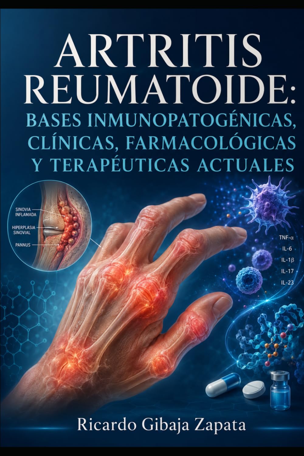 Artritis Reumatoide Bases inmunopatogénicas, clínicas, farmacológicas y terapéuticas actuales