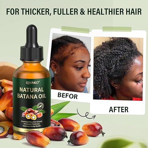 Miniatura 5 de RIHAKO Regalo del día de San Valentín para mujeres Suero para el crecimiento del cabello, aceite de batana para el crecimiento del cabello, 100%