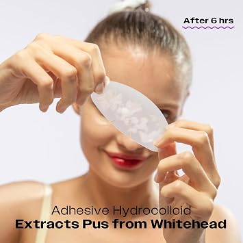 AVARELLE Night-time & Nose Care Kit Pimple Patches | Hydrocolloid Acne Patches for Blemishes and Zit for Face, Vegan, Cruelty Free
