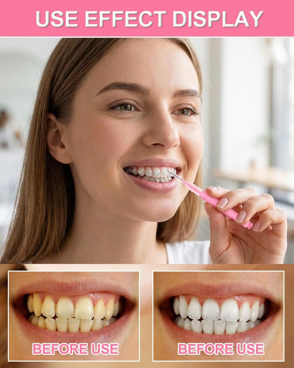 50 Pezzi Scovolini Interdentali,Scovolino per Pulizia Denti con Coperchio per Apparecchi Dentali,Scovolino Denti Morbido per Pulizia Interdentale,L'Igiene Orale(10 Colori)