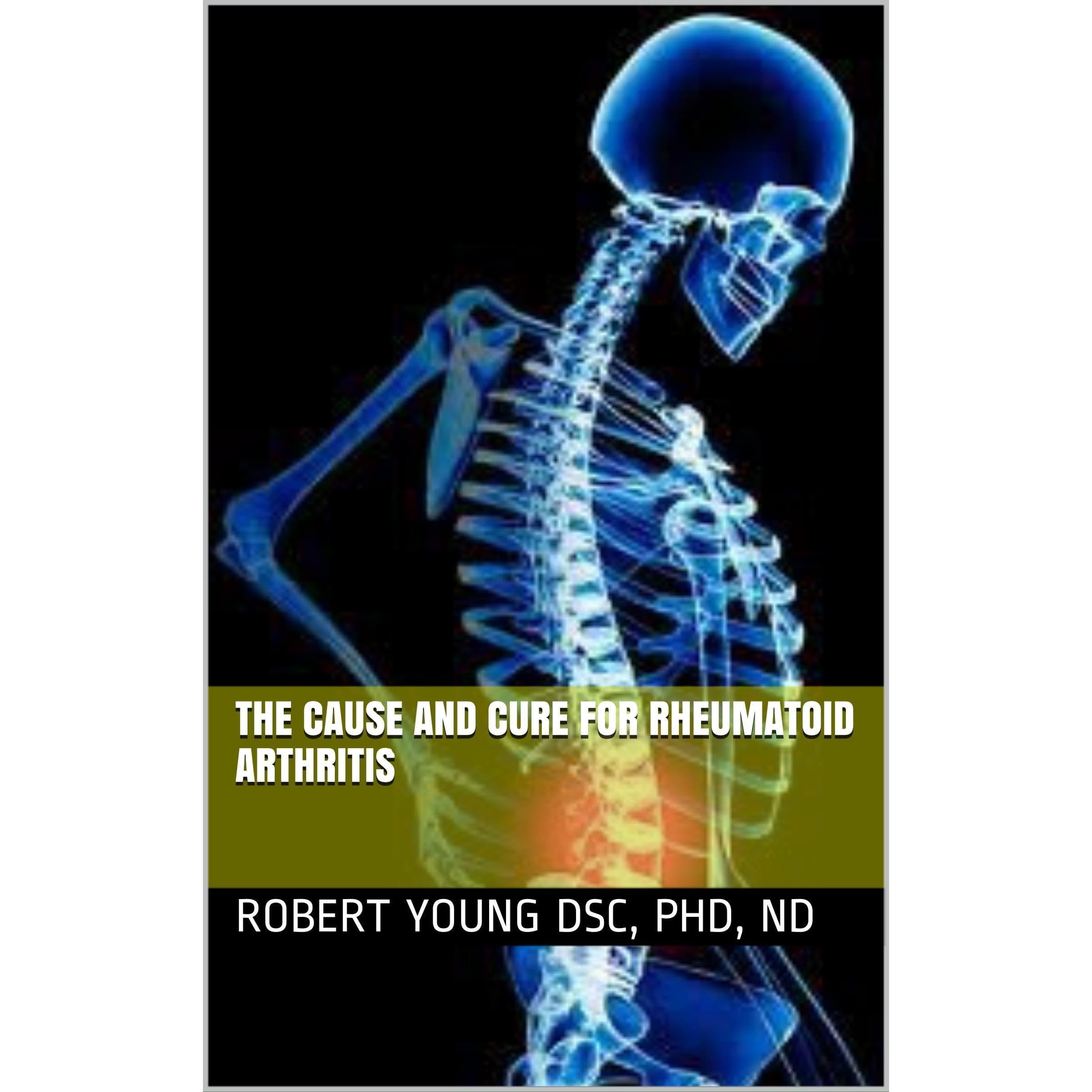 The Cause and Cure for Rheumatoid Arthritis