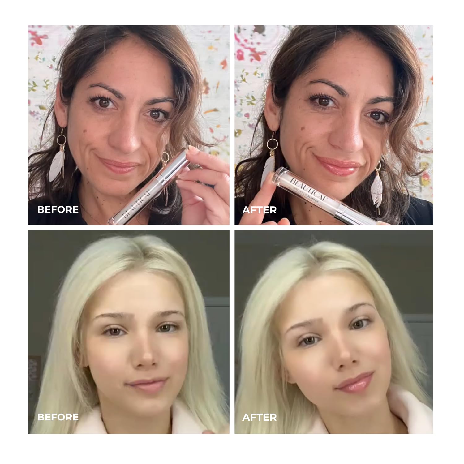 Sofortiger Lippenauffüller | aufgefüllte & füllige Lippen | vollere & weichere Lippen | reduziertes Erscheinungsbild von feinen Linien | Hyaluronsäure | helles Serum | 5 ml