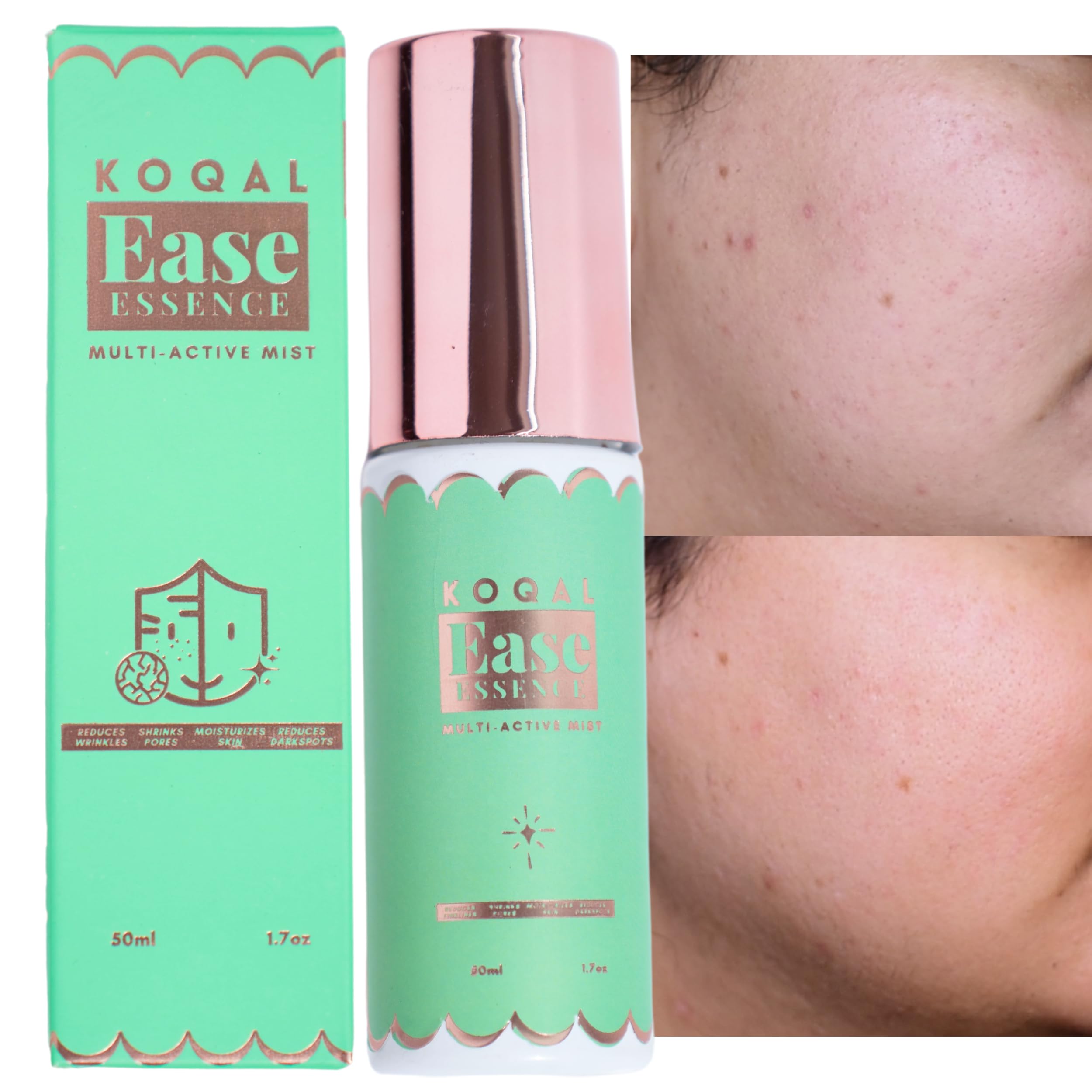 Ease Gel Essence Reduces Fine Lines, Reduces Dark Spots, Boosts Collagen And Enhances Glowing Skin For Aging Skin