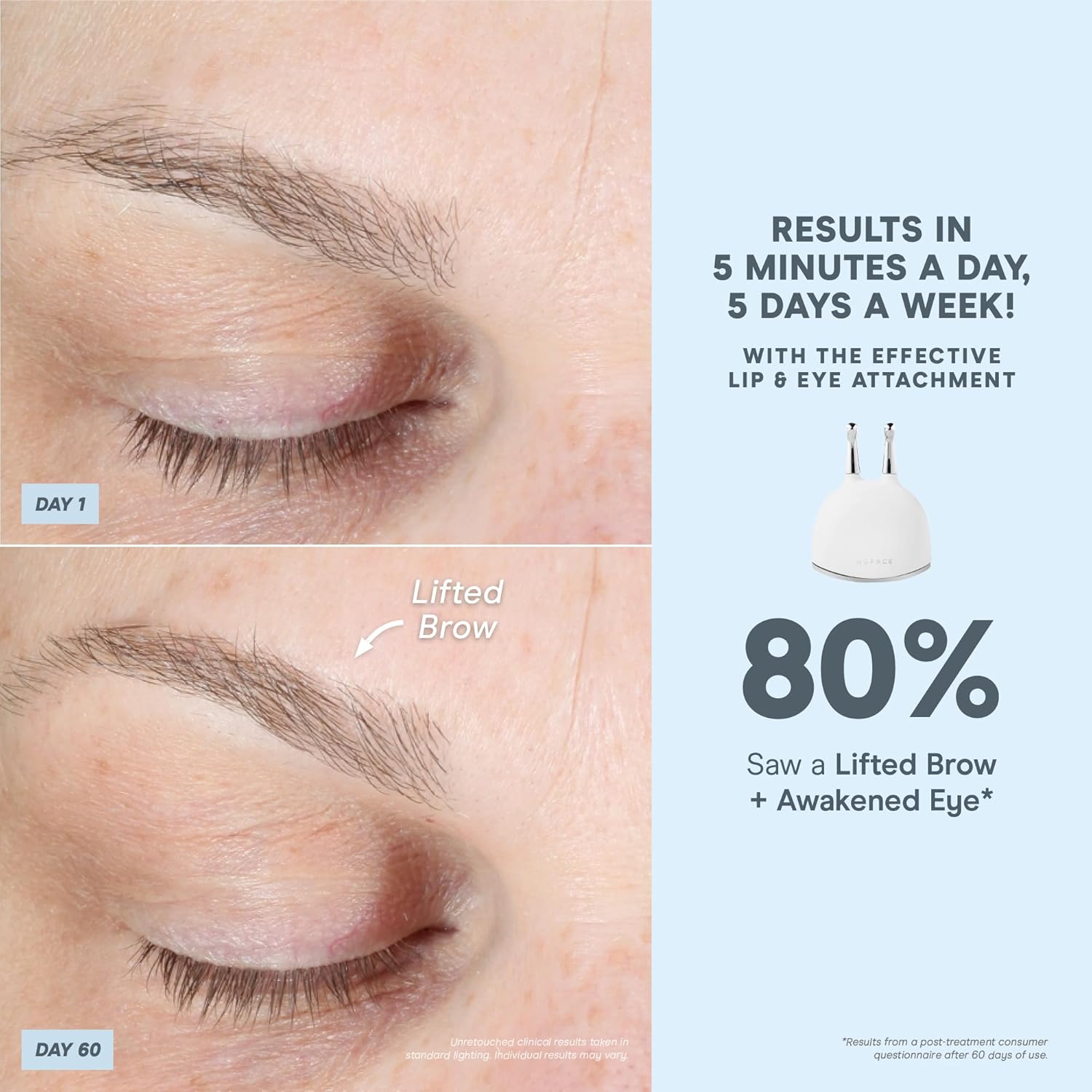 NuFACE TRINITY+ Effective Lip & Eye Attachment for Microcurrent Facial Device - FDA Cleared At Home Eye Lift & Smile Lines Treatment to Tighten & Tone Hard-to-Reach Areas Around Mouth and Eyes