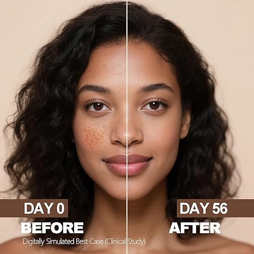Miniatura 4 de SINPIN Aobenz - Removedor de manchas oscuras para rostro y cuerpo, suero corrector avanzado para la edad, melasma, sol, acné, manchas negras, ácido