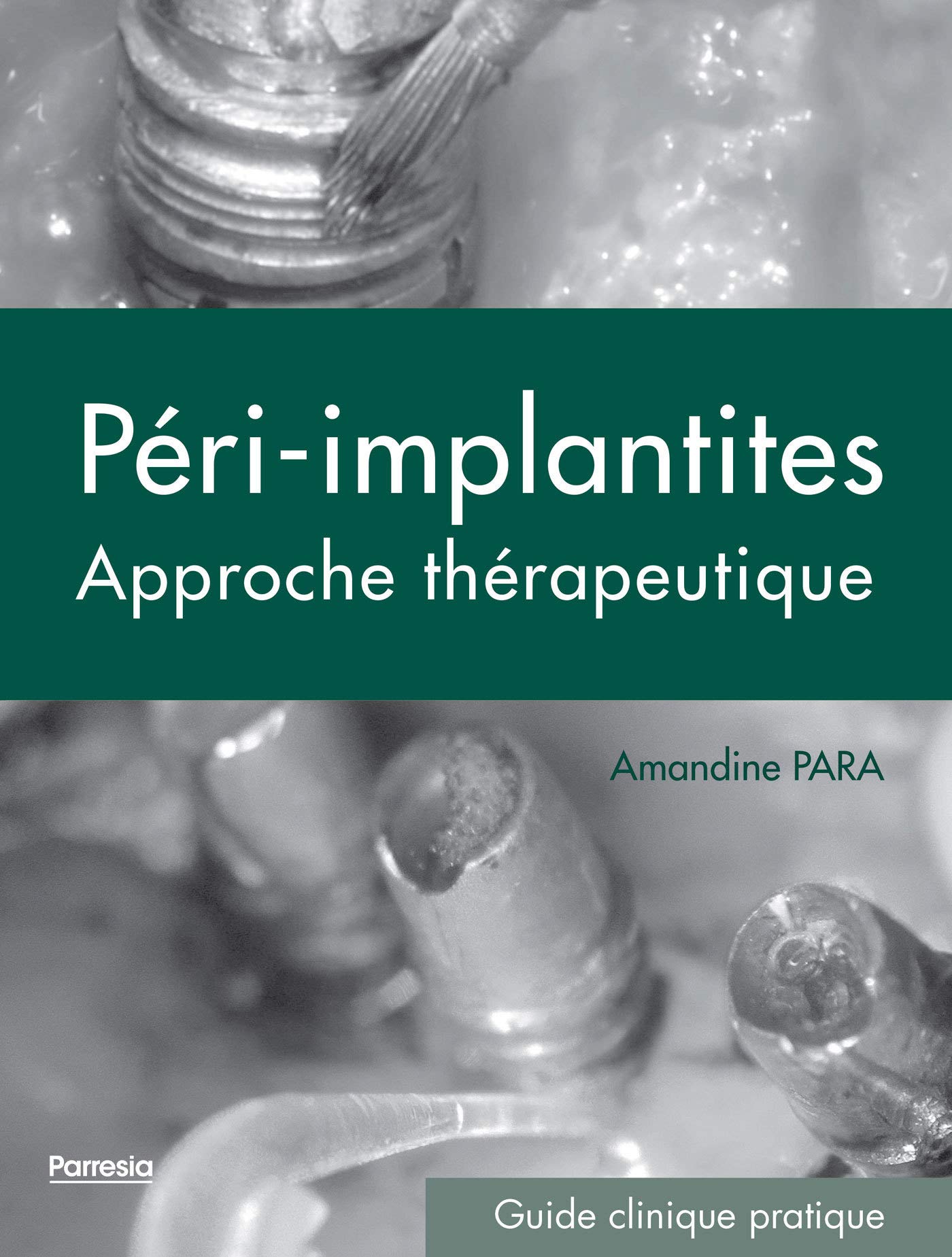 LES PÉRI-IMPLANTITES: UNE APPROCHE THÉRAPEUTIQUE