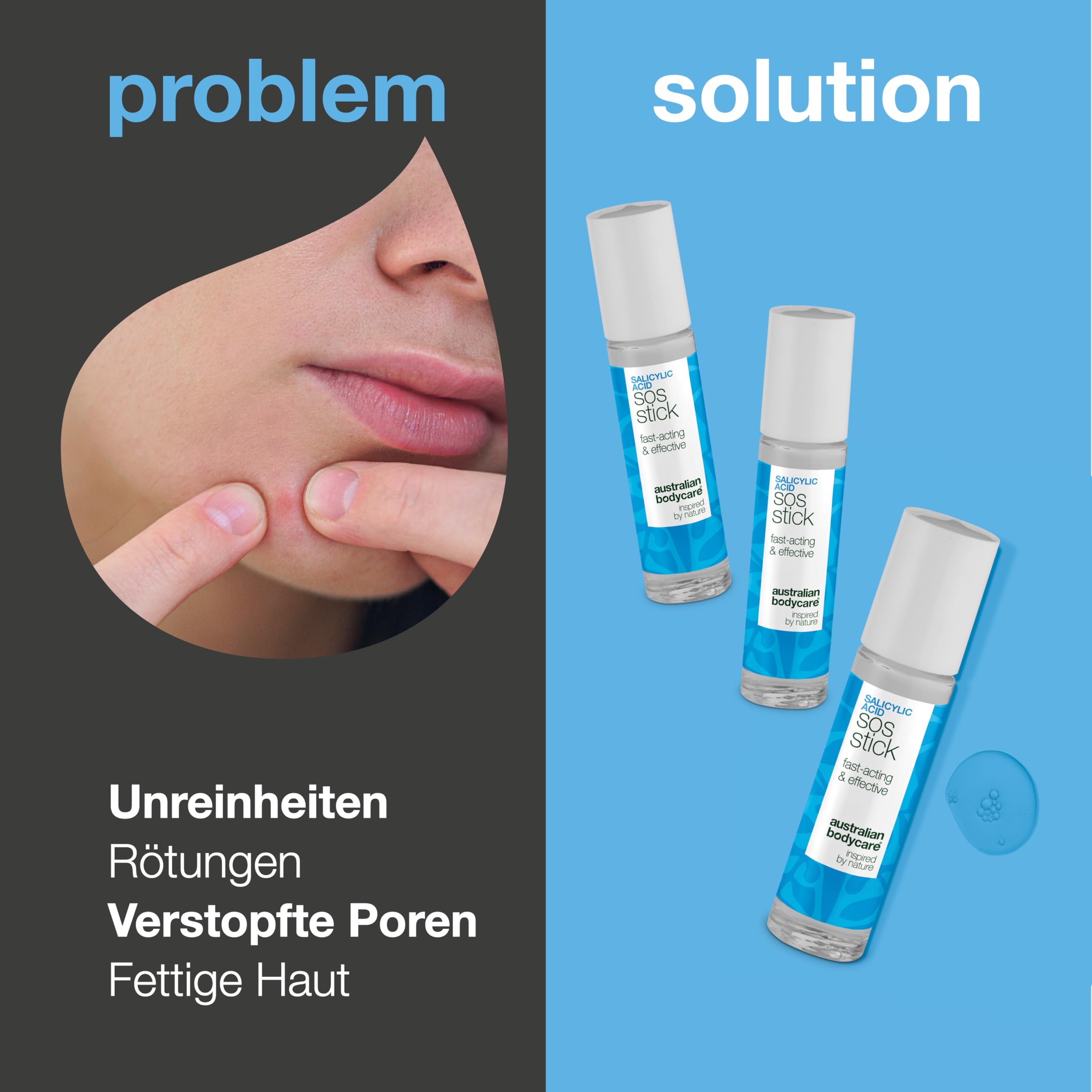 Salicylsäure SOS Stick gegen Pickel, Mitesser, Rötungen und verstopfte Poren – schnelle Hilfe für unreine Haut mit Salicylic acid - 3x9 ml