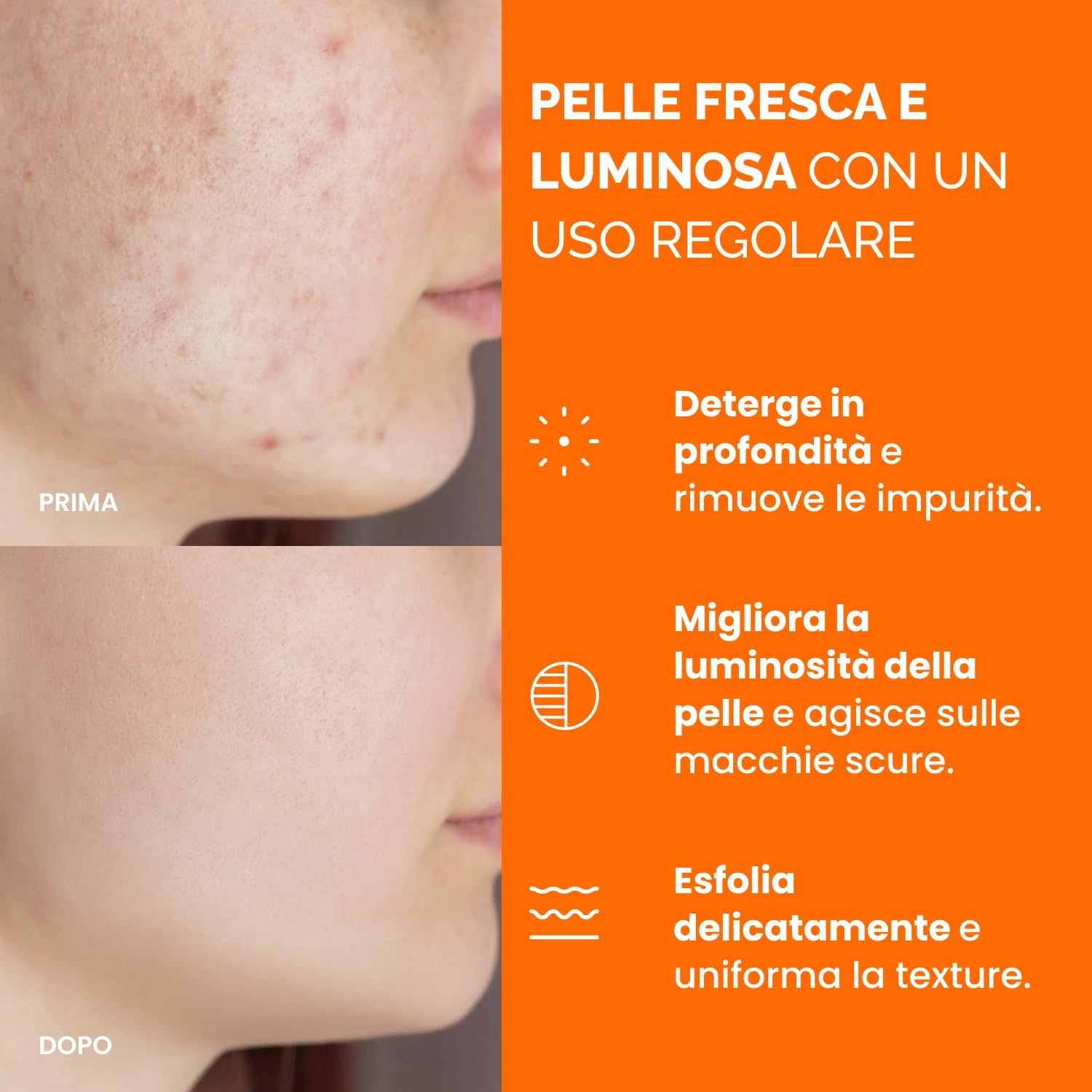 PLANTIFIQUE Dischetti Detergenti al Curcuma e Acido Kojico con Ceramidi, Niacinamide e Vitamina C – 60 Dischetti Esfolianti Viso per Macchie Scure e Iperpigmentazione – Skincare Kit Viso