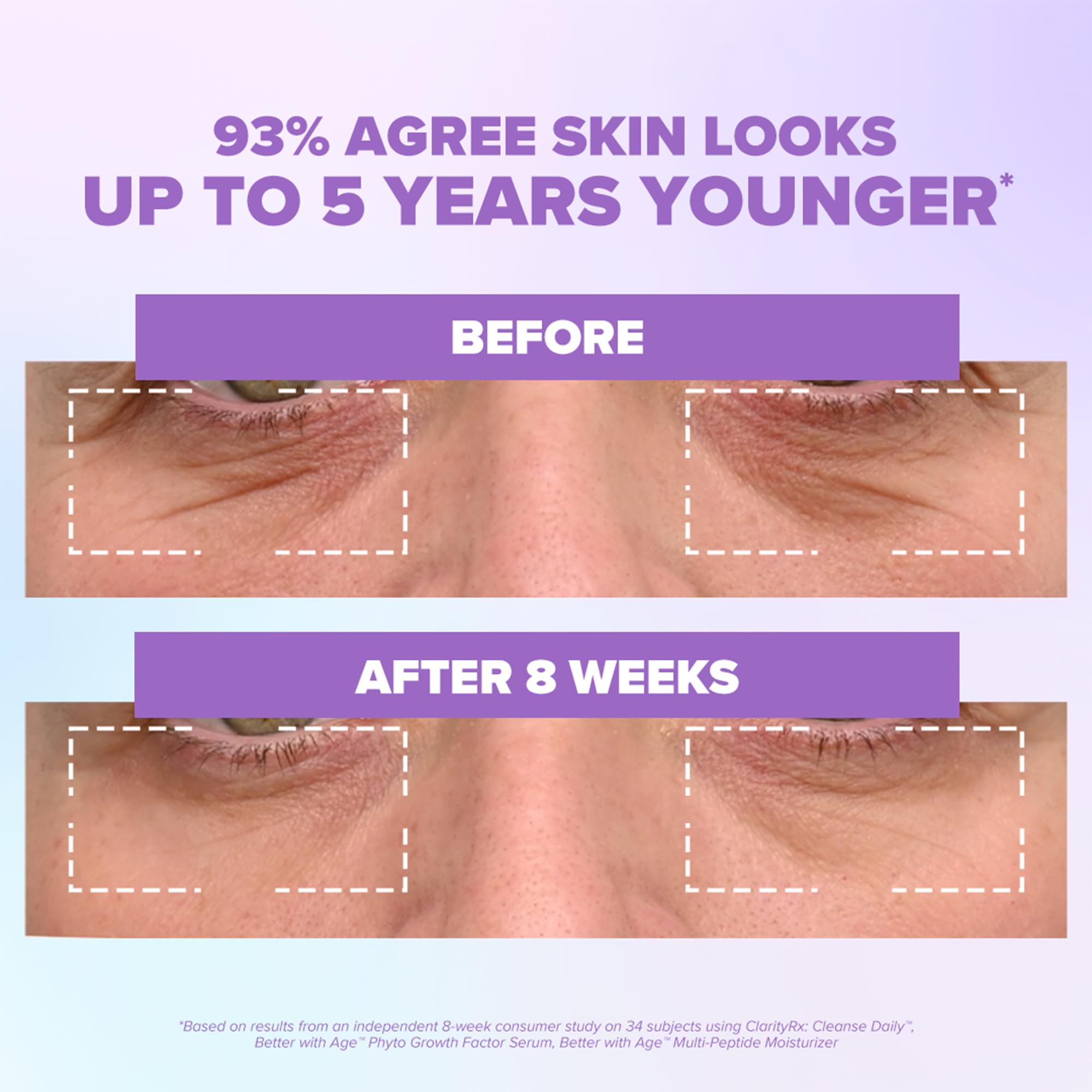 ClarityRx Better With Age Phyto Growth Factor Face Serum, 0.9 Fl Oz, Anti-Aging Hydrating Serum with Plant Stem Cells, Helps Support Collagen & Hyaluronic Acid Production, Visibly Smooths Fine Lines