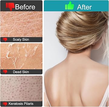 Exfoliating Gloves, (4pcs) Durable Body Scrub, Dead Skin Remover & Body Scrubber Exfoliator, Body Exfoliating Gloves for Shower, washcloth exfoliating, exfoliating Glove for Smooth Skin